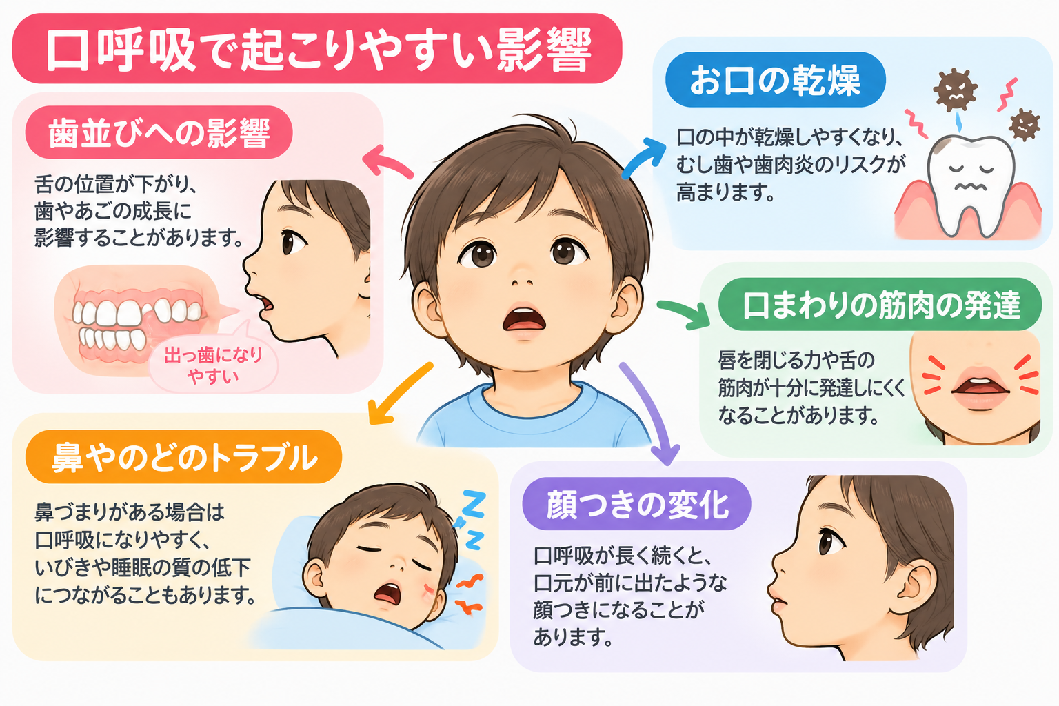 子どもの口呼吸による口の乾燥・舌の位置・歯並びへの影響を説明するイラスト