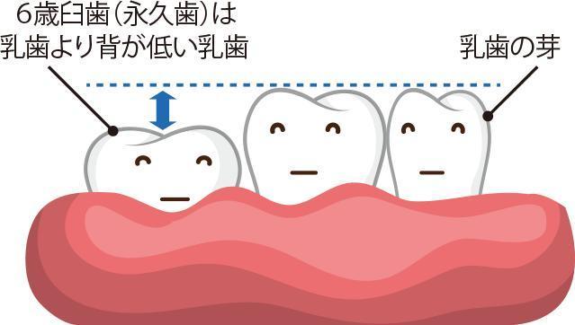 六歳臼歯は背が低い
