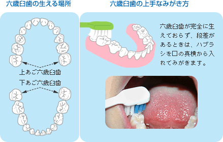 六歳臼歯生える場所や上手な磨き方のイラスト